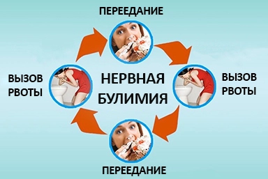 Лечение булимии в Косихе